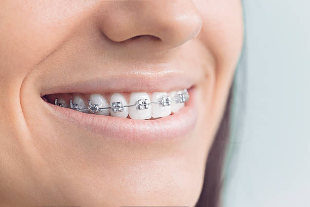 Best Traditional Braces  in Valley Hill, NC